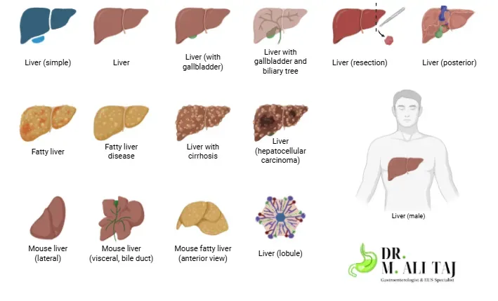 Medical illustration showing the liver structure and different liver types