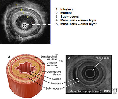 Advancements in Endoscopic Ultrasonography: Focusing on the Esophagus and Mediastinum