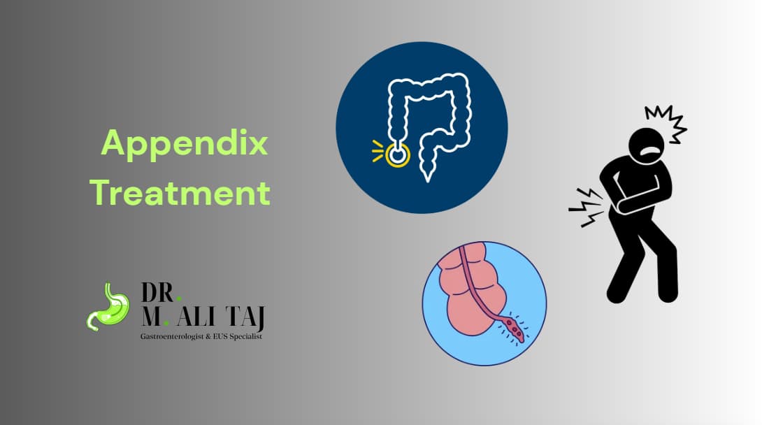 Appendix Ka Operation Aur Ilaj