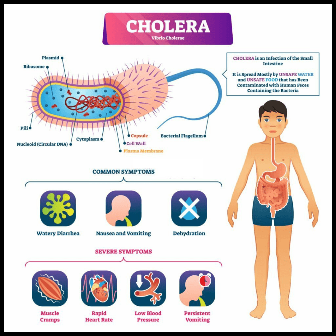 Cholera Treatment & Prevention - Expert Gastroenterology Care in Karachi