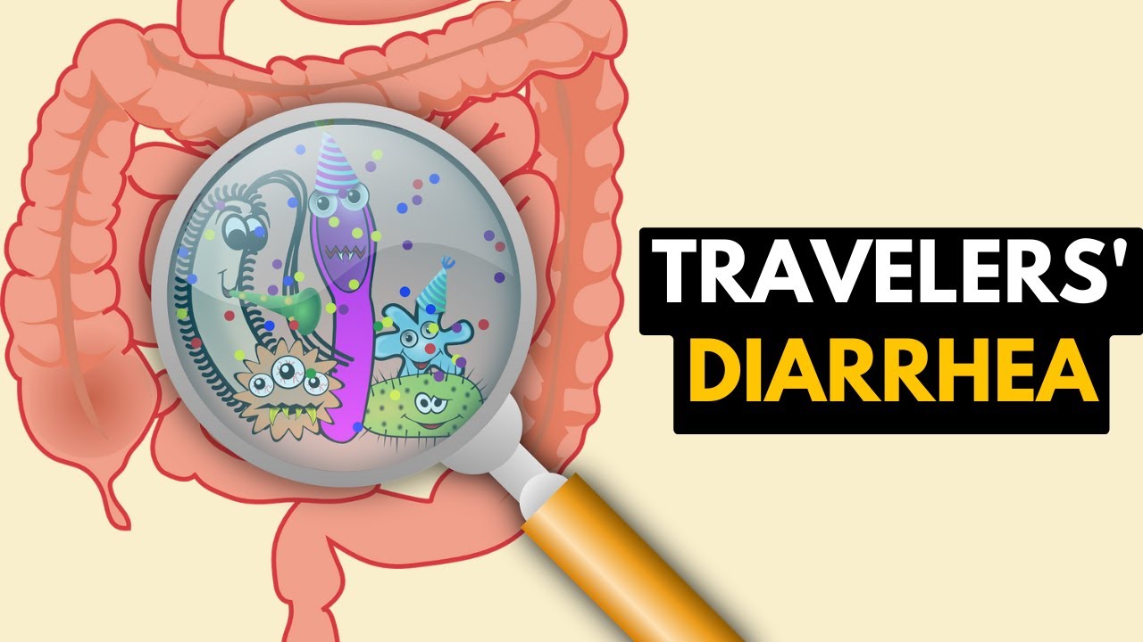 Travelers Diarrhea Treatment Karachi | Dr. Ali Taj