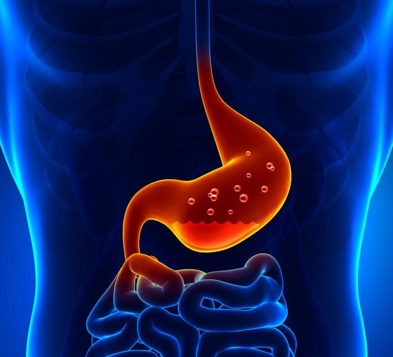Low Stomach Acid Reflux Treatment | Dr. Ali Taj Karachi