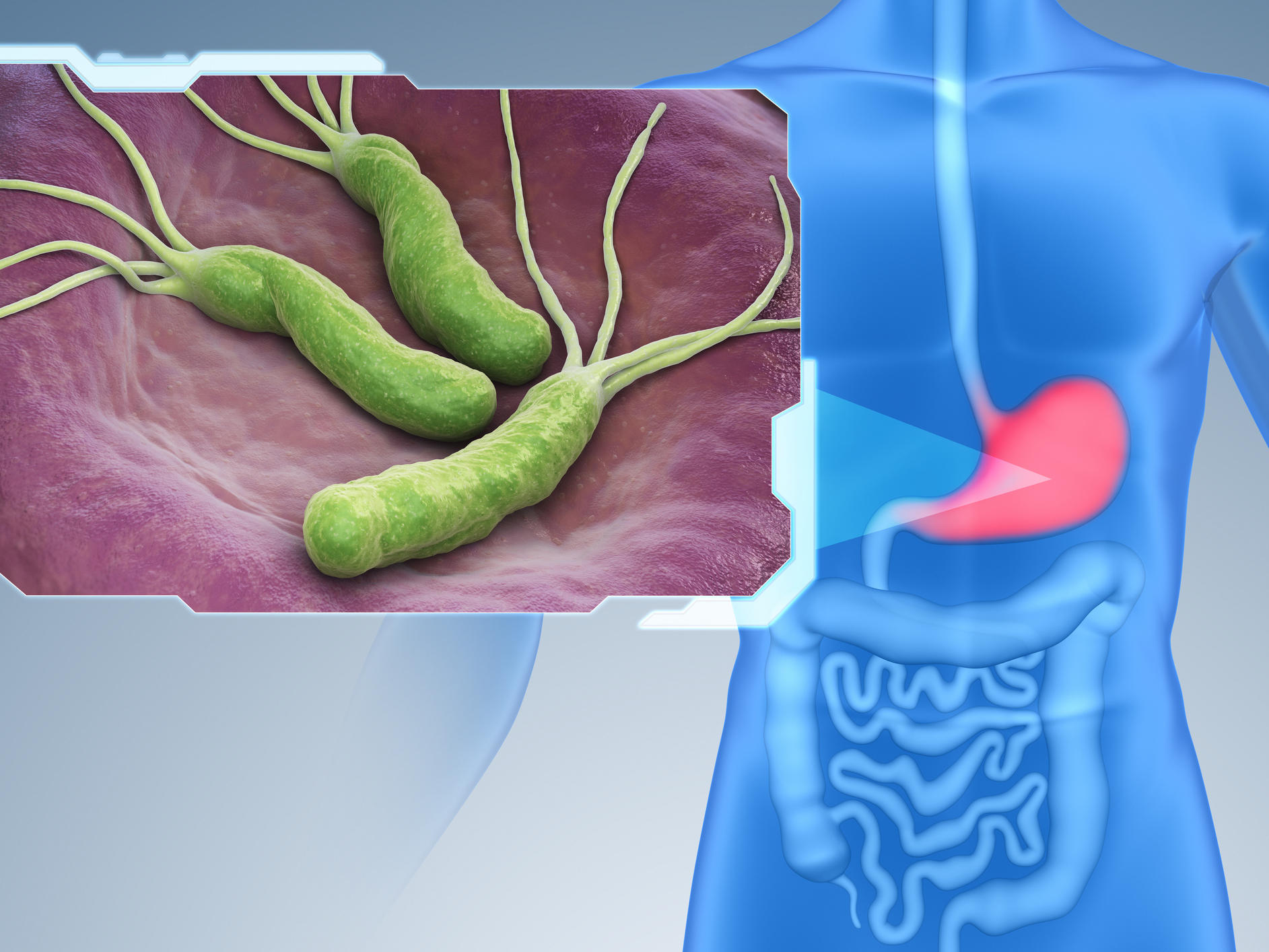 Pait Mein Infection: Causes, Symptoms, and Treatment - Expert Gastroenterology Care